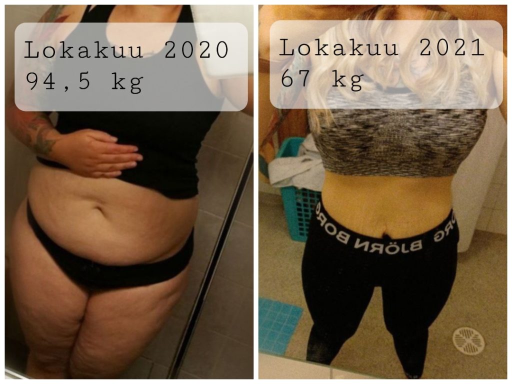25 kg laihdutus ennen ja jälkeen kuvina